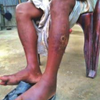 Medical and Relief Aid